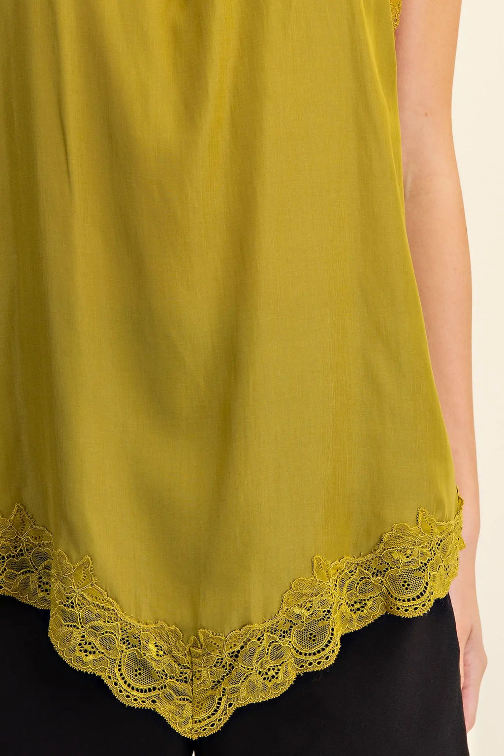 Aurelia Top